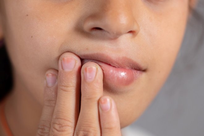 A transmetohet HPV përmes seksit oral?
