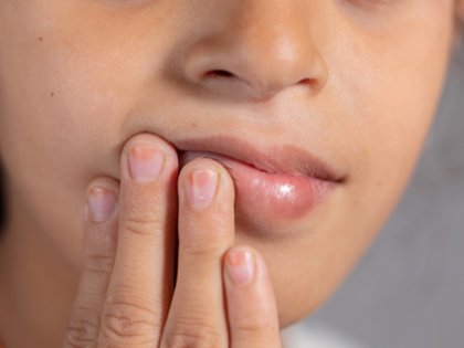A transmetohet HPV përmes seksit oral?